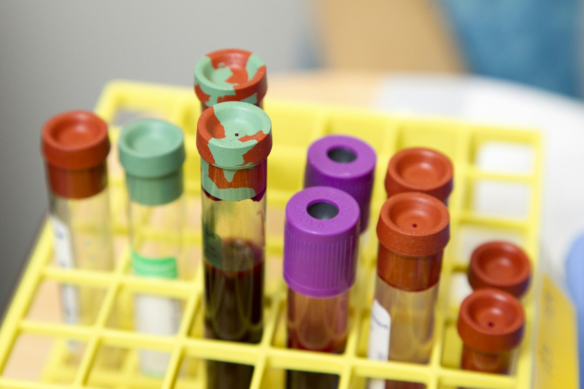 Capped blood sample tubes standing upright in a laboratory rack.